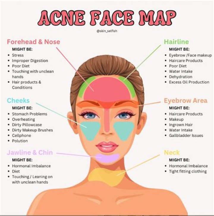 Cardi B Begs Fans For Advice On How To Clear Up Her Acne — See Pic