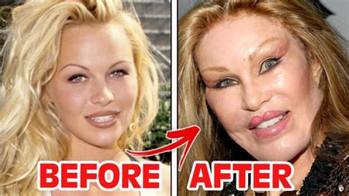 Different Appearance After Denying Plastic Surgery – Hollywood Life