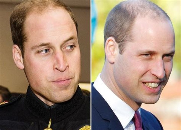 Duke Of Cambridge Shows Off Much Shorter ‘Do – Hollywood Life