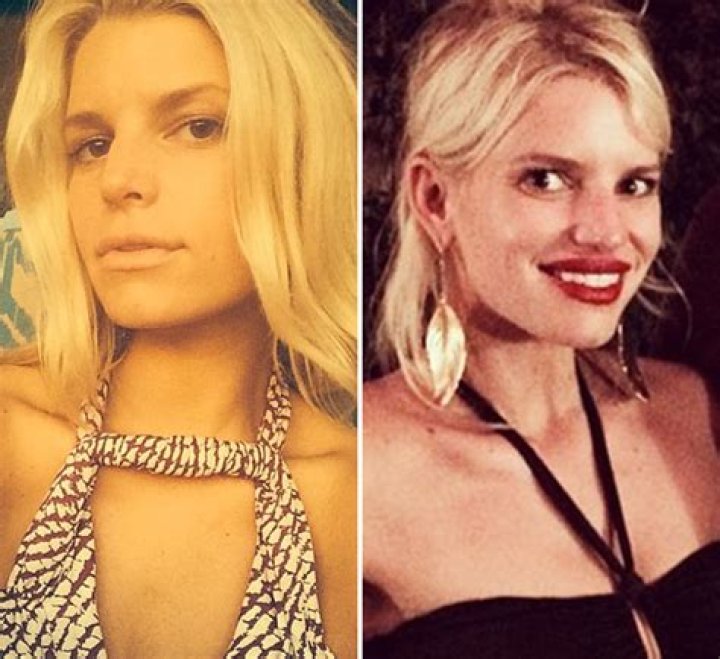 Jessica Simpson’s Lip Fillers — Doctors Speculate On Plastic Surgery – Hollywood Life