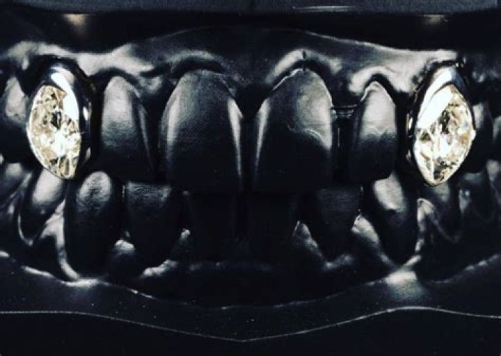 Post Malone Shows Off Diamond Fangs In Smile Makeover – Hollywood Life