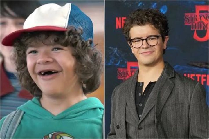 ‘Stranger Things’ Gaten Matarazzo’s Teeth & Bone Disorder – Hollywood Life