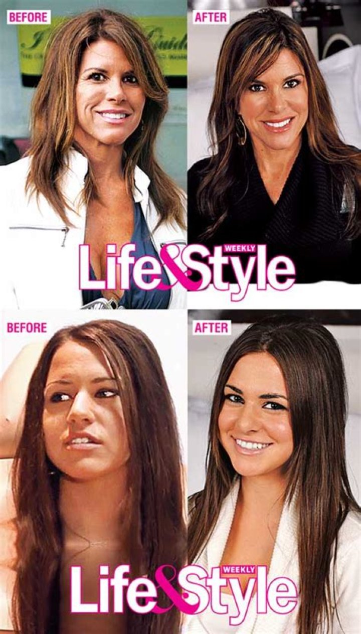 Would You Get Plastic Surgery With Your Mom, Like OC “Housewife” Lynne Curtin? – Hollywood Life